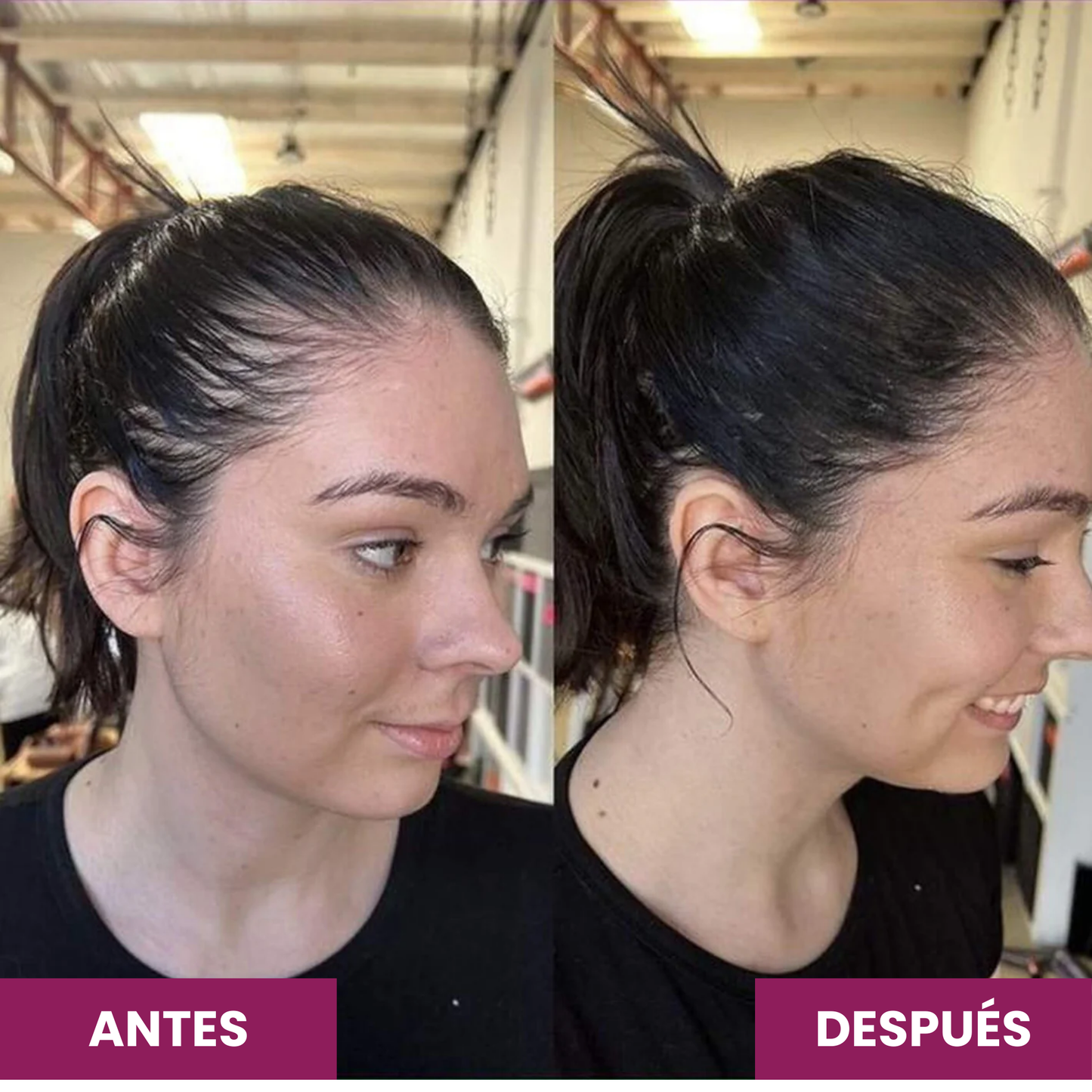 Elúviya® - Vitaminas Avanzadas para el Pelo - Resultados Reales para Cabello Fuerte y Abundante