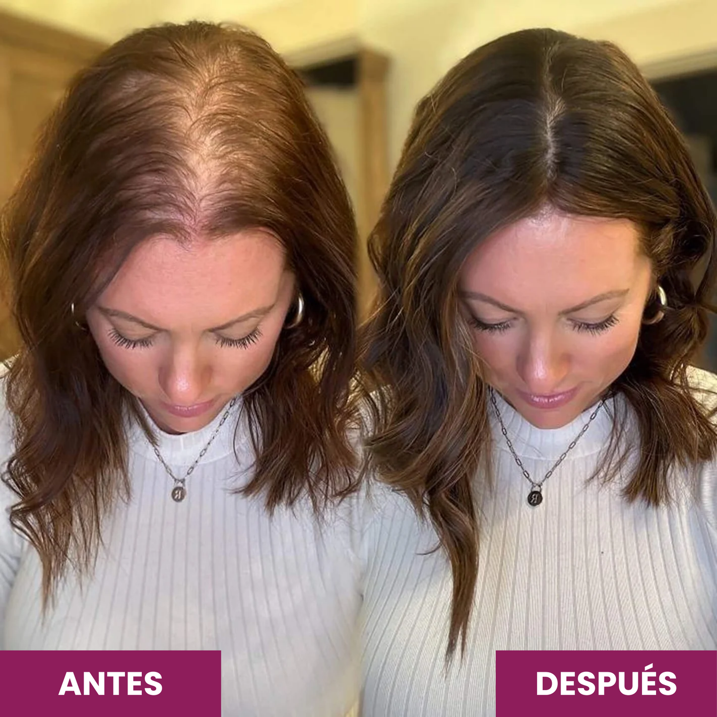 Elúviya® - Vitaminas Avanzadas para el Pelo - Resultados Reales para Cabello Fuerte y Abundante
